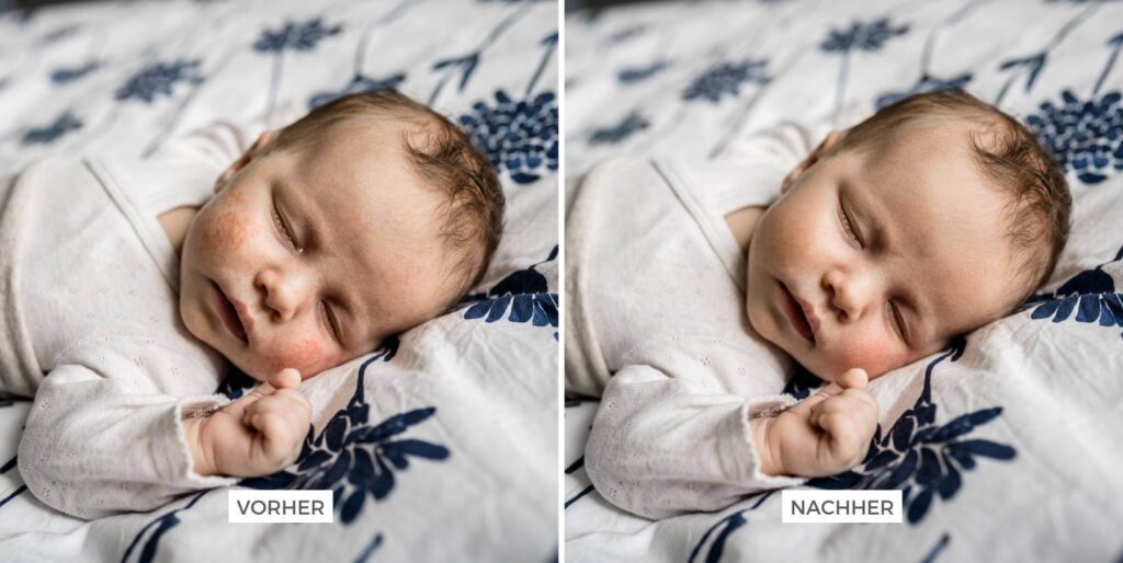 Collage Vergleich Bildbearbeitung, Babyakne entfernen, Babyshooting Pickel Hannover, Julia Schlenkrich