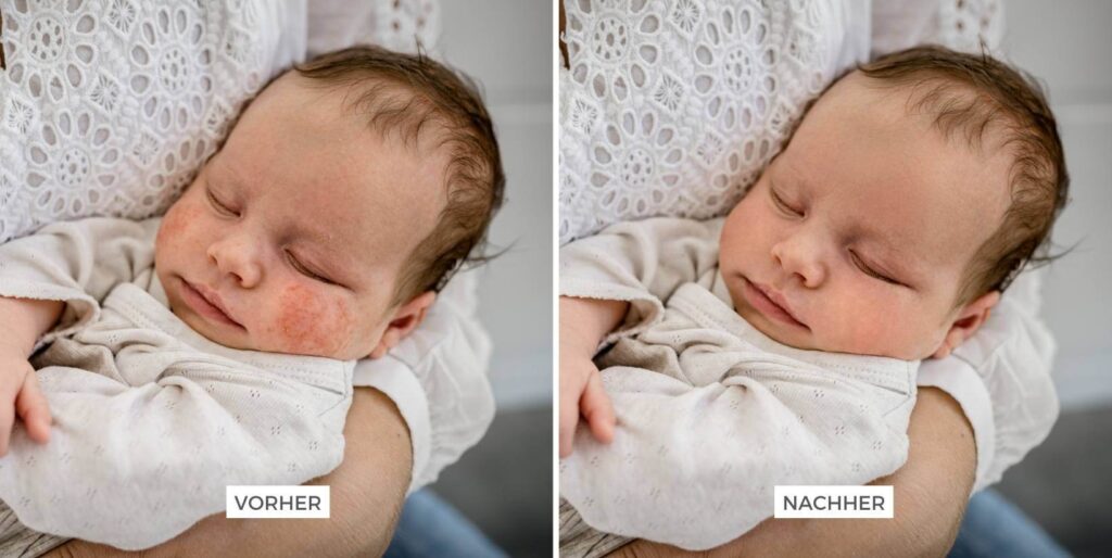 Collage Vergleich Bildbearbeitung, Babyakne entfernen, Babyshooting Hannover, Julia Schlenkrich Fotografie